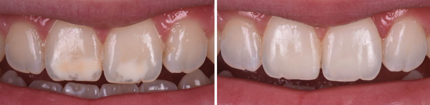 White Spot Dental Treatments Buckingham