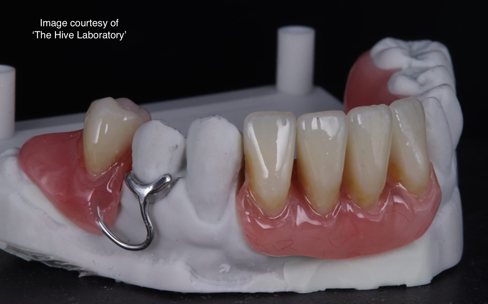 Denture Specialist Milton Keynes